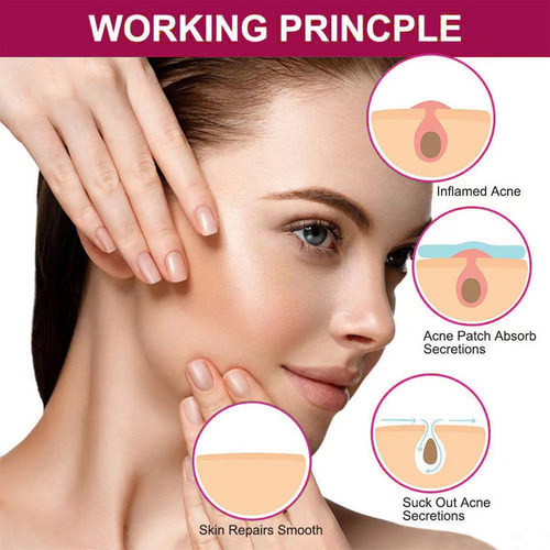 Parche Hidrocoloide Para Espinillas Face Skin Vegan Cruelty,