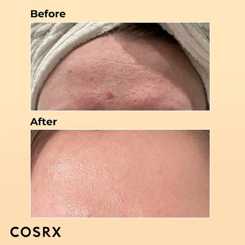 Suero Hidratante Para Rostro Cosrx Snail Mucin Momento de aplicación Día/Noche Tipo de piel Todo tipo de piel