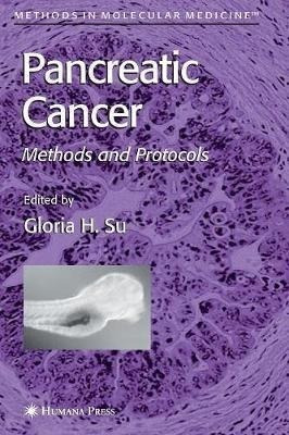 Pancreatic Cancer - Gloria H. Su