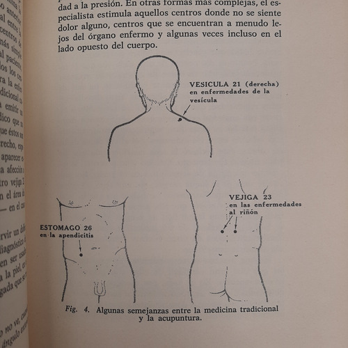 Acupuntura. Felix Mann