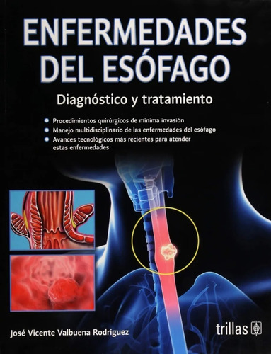 Enfermedades Del Esófago: Diagnóstico Y Tratamiento, De Valbuena Rodriguez, Jose Vicente., Vol. 1. Editorial Trillas, Tapa Blanda En Español, 2018
