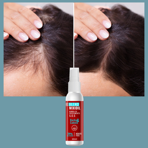 Kit Microagulhamento Dermaroller Crescimento De Barba Cabelo