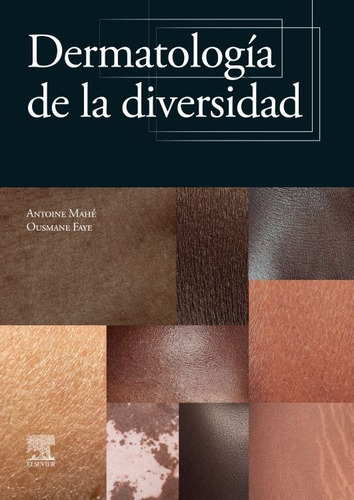 Dermatología De La Diversidad Mahé. Antoine 1ra Edición, De Antoine Mahé & Ousmane Faye. Editorial Elsevier En Español