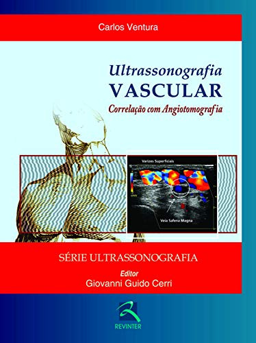 Libro Ultrassonografia Vascular De Carlos Giovanni Guido; Ve