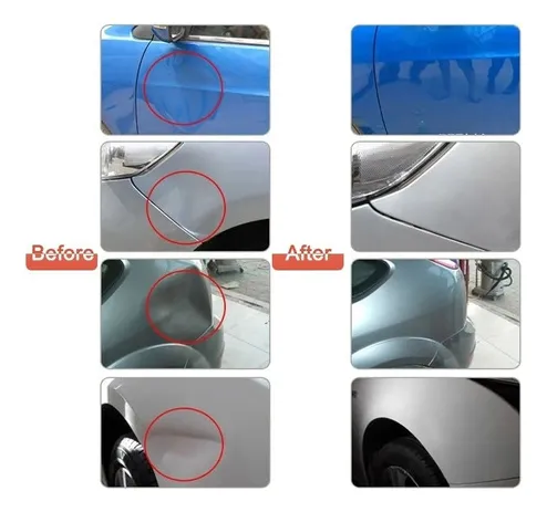 Kit Saca Golpes De Autos Carros Ventosa P/abolladuras 40pcs