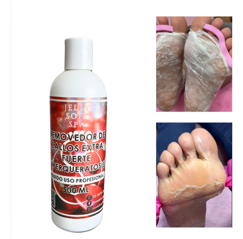 Removedor De Callos Hiperqueratosis 500ml
