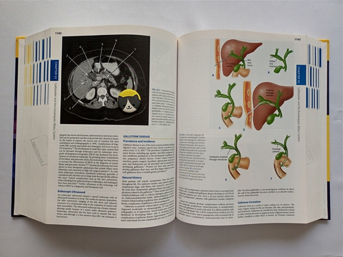 Libro Schwartz's Principles Of Surgery, Ninth Edition 123a1 (Usado)
