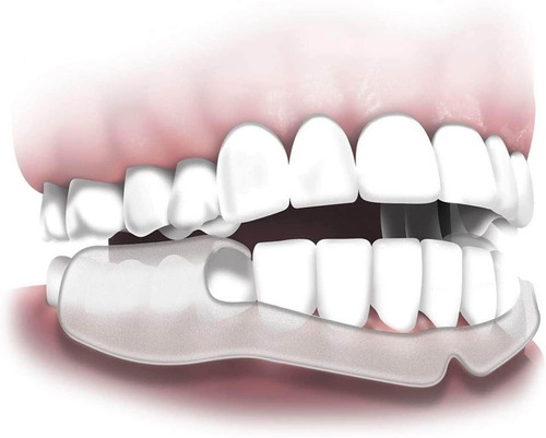 Protección Nocturna Desechable Para No Rechinar Los Dientes