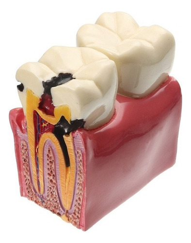 Modelo De Dientes De 6 Veces, Modelos De Estudio Comparacion