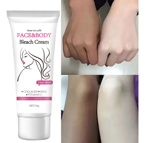 Crema Iluminadora Para Partes Íntimas: Eliminar Las Rodillas