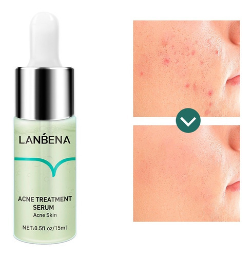 Serum Lanbena Anti Acné Tratamiento 15ml Cuidado Facial Full Tipo de piel Normal