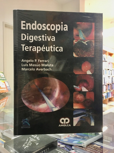 Endoscopia Digestiva Terapéutica