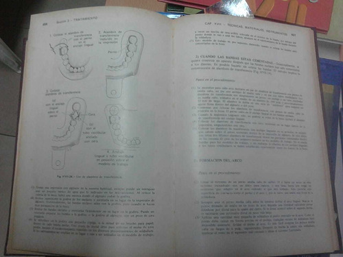 Manual De Ortodoncia - Robert Moyers