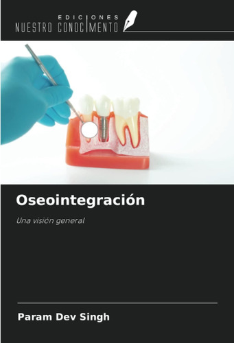 Libro: Oseointegración: Una Visión General (spanish Edition)