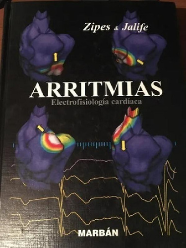 Libro - Arritmias Electrofisiología Cardíaca, De Zipes Y Ja