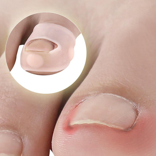 // Gel Para De Uñas De Pies Encarnados De Silicona De 5