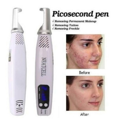 Imagen 5 de 7 de Laser Picosecond Neatcell