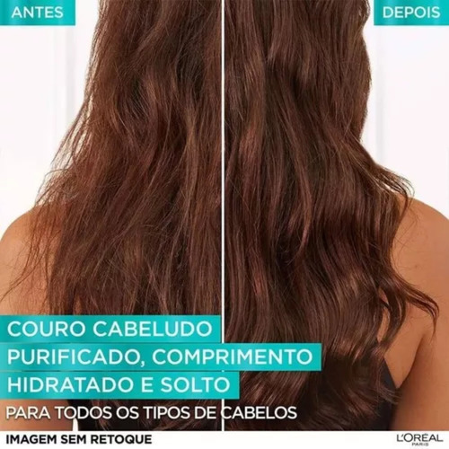 Kit Elseve Pure Hialurônico Shampoo + Condicionador 200ml