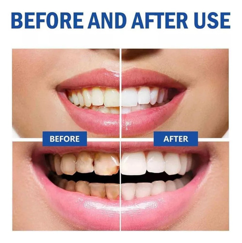 Cc 3x Pasta Dientes Probiótica Sp-10 Para Blanquear Los