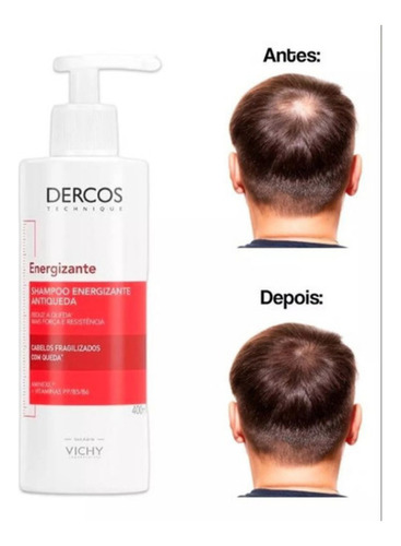 Shampoo Dercos Antiqueda 400ml Kit C/2 Vichy Energizante