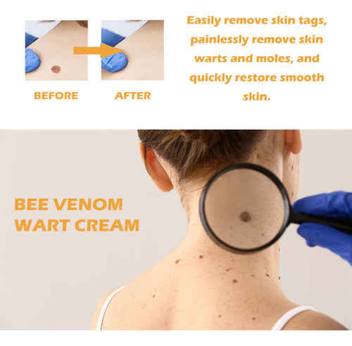 3×crema Verrugas Veneno Abeja 20g A