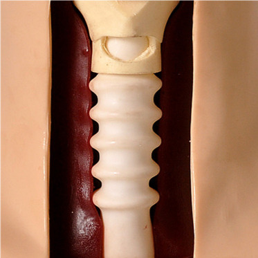 Modelo Anatômico Simulador De Traqueostomia Anatomic