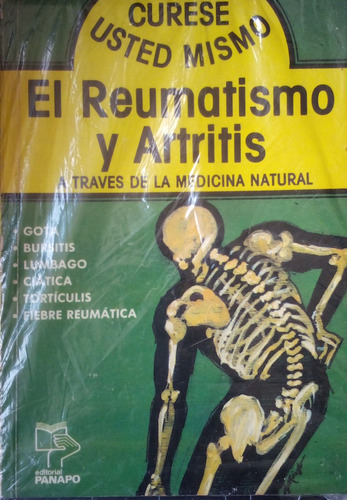 El Reumatismo Y Artritis A Traves De La Medicina Natural