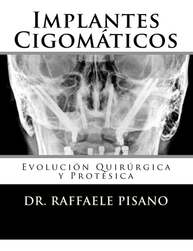 Libro:implantes Cigomáticos: Evolución Quirúrgica Y Protésic