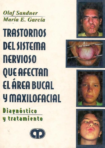 Libro Trastornos Del Sistema Nervioso Que Afectan El Área Bu