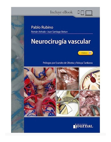 Neurocirugía Vascular Nuevo Rubino / Arévalo / Bottan Envío