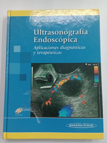 Ultrasonografia Endoscópica - M. J. Varas Lorenzo