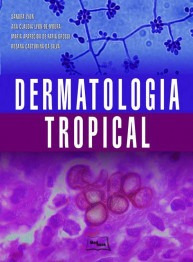 Livro Dermatologia Tropical