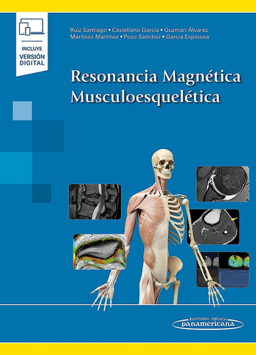 Resonancia Magnética Musculoesquelética - Ruiz