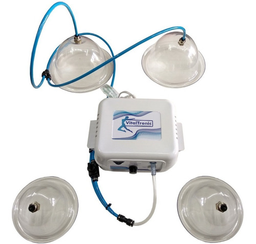 Imagen 2 de 3 de Vacumterapia Equipo 4 Copas Xxl L Para Gluteos Busto Abdomen