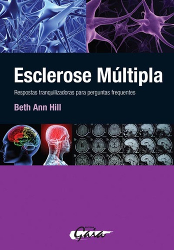 Esclerose múltipla: respostas tranquilizadoras para perguntas frequentes, de Hill, Beth Ann. Editora Grupo Editorial Global, capa mole em português, 2010