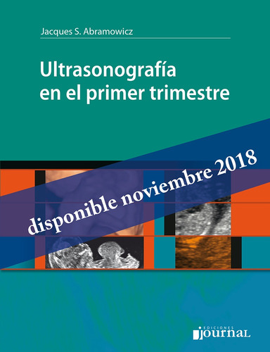 Ultrasonografia En El Primer Trimestre - Abramowicz, Jacques