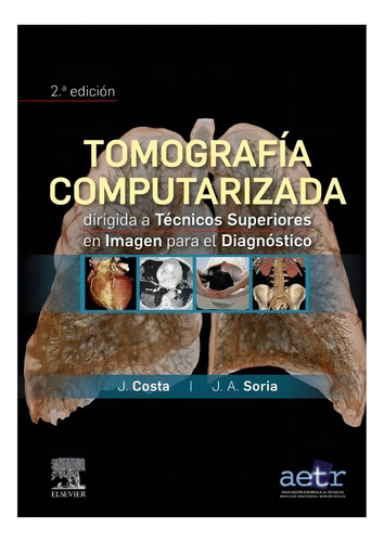Costa / Tomografía Computarizada