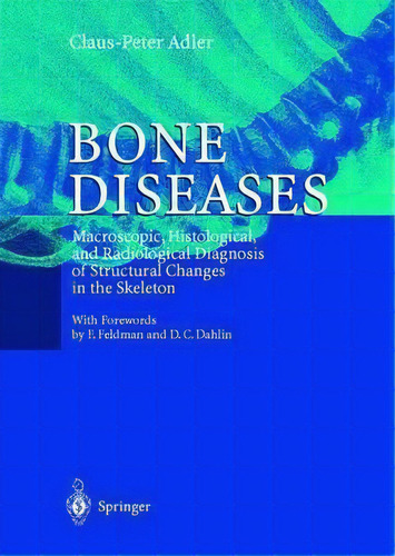 Bone Diseases, De Claus-peter Adler. Editorial Springer Verlag Berlin Heidelberg Gmbh Co Kg, Tapa Dura En Inglés