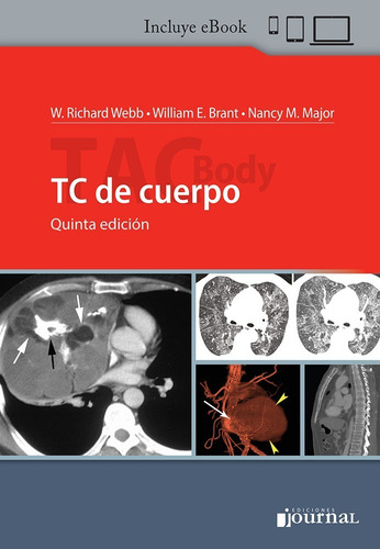 Webb Brant Tac Body - Tc De Cuerpo 5ed/2020 Nuevo C/envío 