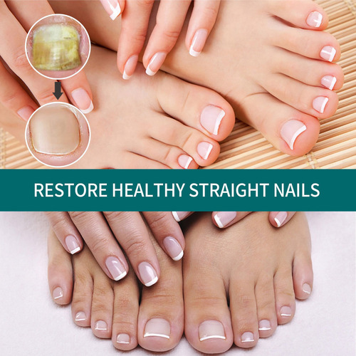 7×reparación La Decoloración Las Uñas Onicomicosis Soft