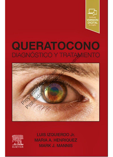 Queratocono. Diagnóstico Y Tratamiento. Izquierdo - Elsevier