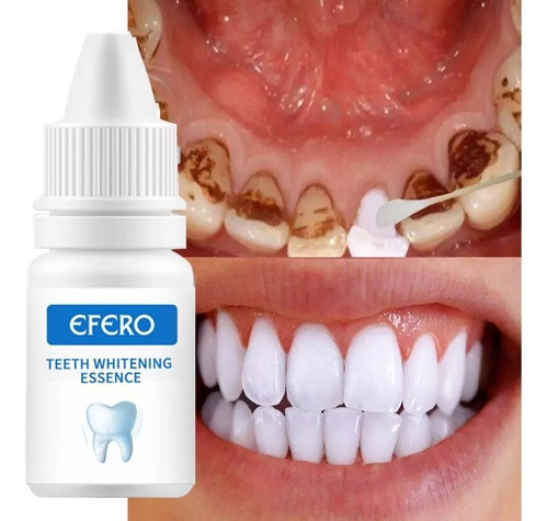Tratamiento Blanqueador Dental Efero Limpiador Higiéne Oral