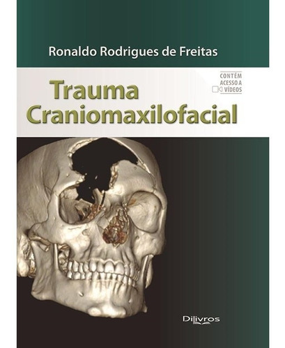 Trauma Craniomaxilofacial, De Ronaldo Rodrigues De Freitas. Editora Dilivros, Capa Dura Em Português, 2020