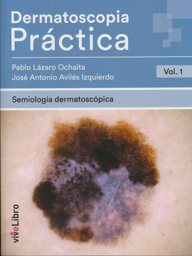 Dermatoscopia Practica Vol 1 Semiologia Dermatoscopica - Laz