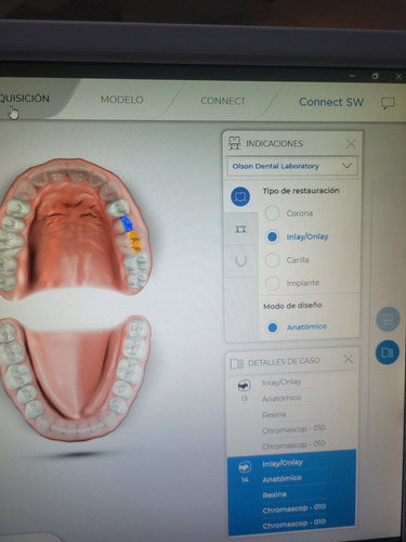 Escaner Intraoral Sirona Cerec Omnicam 3d Conect