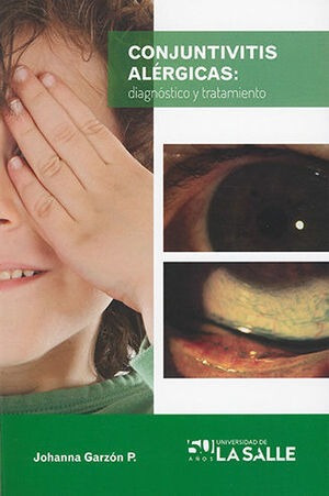 Libro Conjuntivitis Alergicas: Diagnostico Y Tratam Original