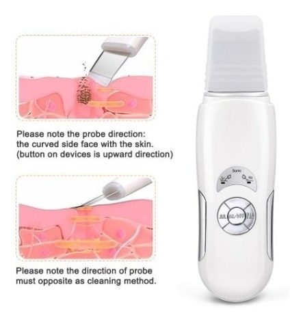 Limpiador Ultrasonido Facial Digital Peeling Lifting Manchas
