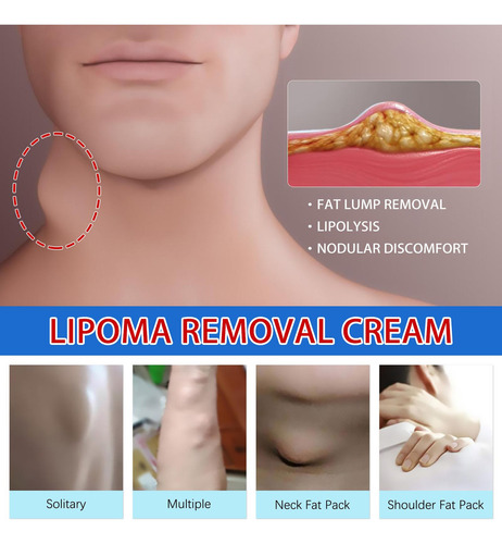 Crema Limpiadora Block Care Products Lipoma Nursing Cream