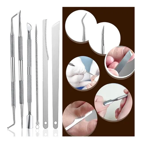 Kit Uñas Encarnadas Corrector Uñeros Y A