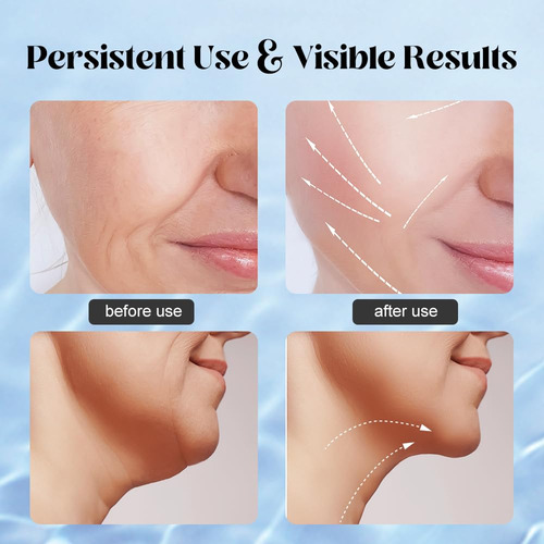 Masajeador Facial Yunruo Neck Sculpting Con 3 Modos De Color